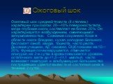 Ожоговый шок средней тяжести (II степень) характерен при ожогах 20—40% поверхности тела, когда глубокие ожоги составляют не более 20%. Он характеризуется возбуждением, сменяющимся заторможенностью. Сознание сохранено. Кожа в области ожога бледная, сухая, холодная. Больного беспокоят озноб, жажда, то