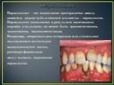 Периодонтит. Периодонтит – это воспаление пространства между цементом корня зуба и стенкой альвеолы – периодонта. Периодонтит появляется в результате нелеченного кариеса и пульпита, но может быть травматическим, токсическим, медикаментозным. Например, неправильная дозировка или длительное нахождение