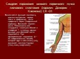 Синдром поражения нижнего первичного пучка плечевого сплетения (паралич Дежерин - Клюмпке) С8 –D1. Выключается функция локтевого, кожных внутренних нервов плеча и предплечья, части срединного нерва (медиальный корешок). Возникает паралич кисти. Невозможны или затруднены также разгибание и отведение 