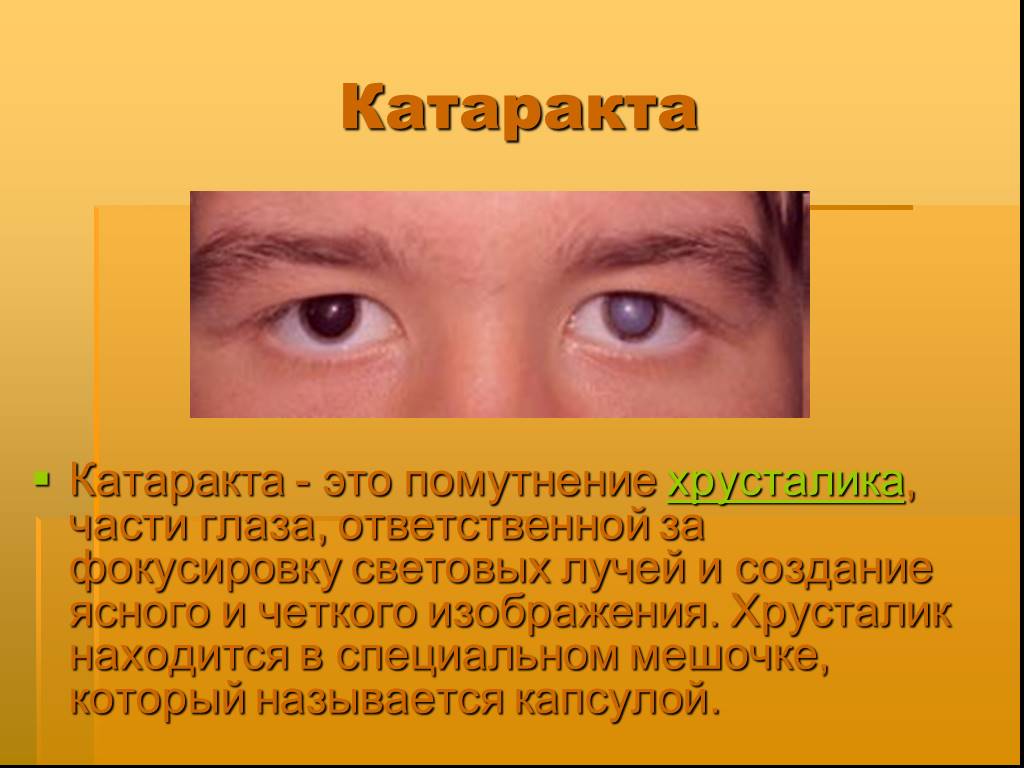 Заболевания глаз биология 8 класс. Заболевание глаз катаракта. Презентация болезни глаз. Катаракта глаза симптомы. Глазные заболевания презентация.