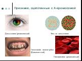 Признаки, сцепленные с Х-хромосомой. Дальтонизм (рецессивный). Гемофилиям (рецессивный). Гипоплазия эмали зубов (Доминантный). Тест на дальтонизм