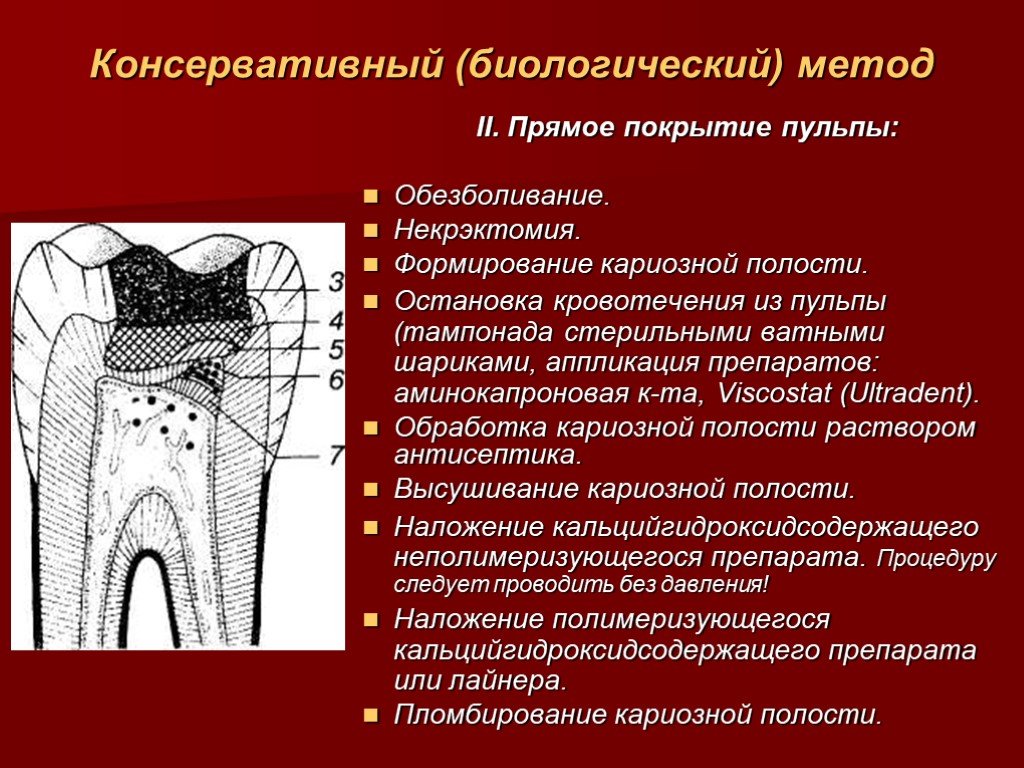 План лечения пульпита