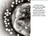 Электронная микрофотография множества бактериофагов, прикрепившихся к бактериальной клеточной стенке