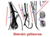 Heterakis gallinarum. головной конец паразита. хвостовой конец самца. хвостовой конец самки. самка самец в натуральную величину. яйца