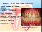 Катаральный гингивит бывает острым и хроническим: Острый катаральный гингивит (К 05.0)– отличается быстроразвивающейся и выраженной симптоматикой. Десна, ярко красного цвета, отечна. Механическое раздражение десны болезненно, вследствие чего пациенты часто отказываются от чистки зубов, что приводит 
