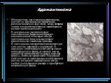 Адамантинома. Монокистома, или солидная адамантинома, состоит из эпителиальных разрастаний, располагающихся в виде ячеек между которыми тонкие соединительнотканные перекладины и мелкие кистозные полости. В центральных участках опухоли эпителиальные разрастания образуют массивные поля, от которых отх