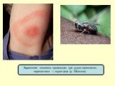 Заражение человека происходит при укусе насекомого-переносчика — мухи цеце (р. Glossina).