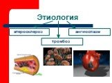 Этиология атеросклероз ангиоспазм тромбоз