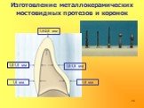 Изготовление металлокерамических мостовидных протезов и коронок. 1,0-1,5 мм 1,5-2,0 мм 1,0 мм
