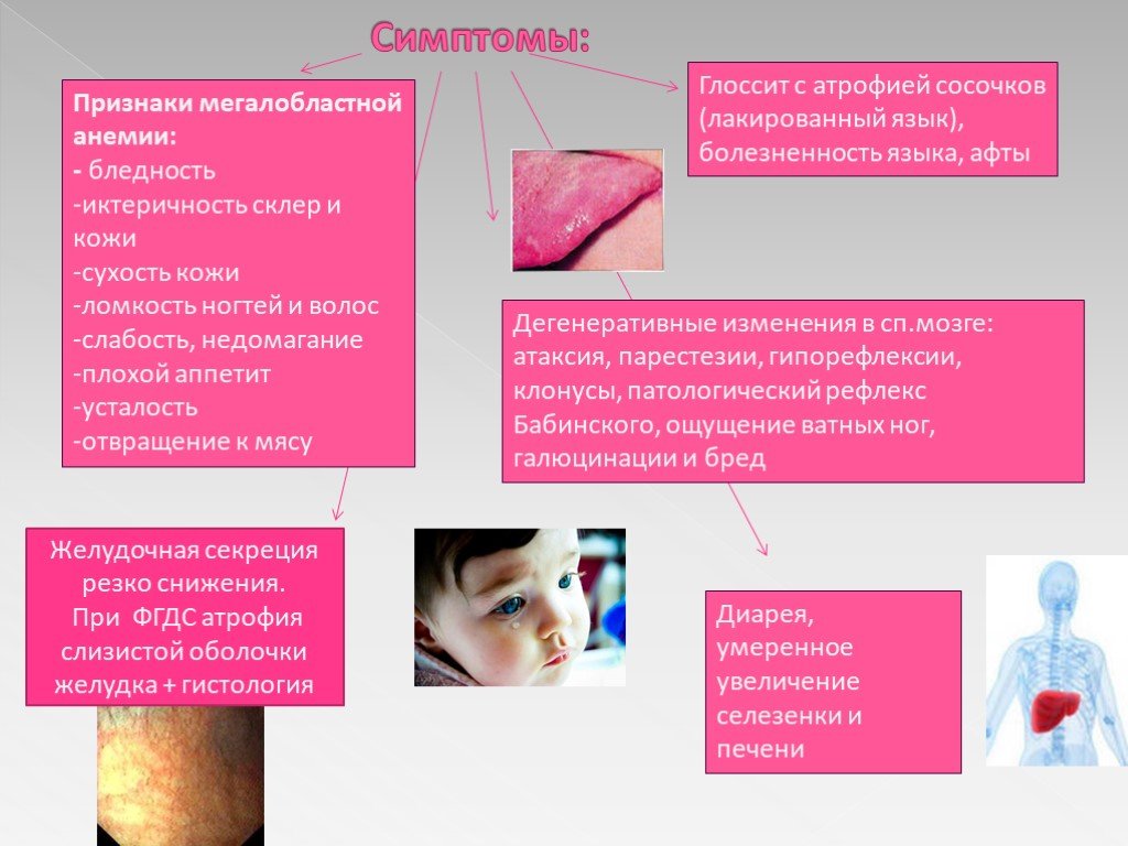 В12 при железодефицитной анемии. Сисптомы анемии у ребёнка. Железодефицитная анемия у детей симптомы.