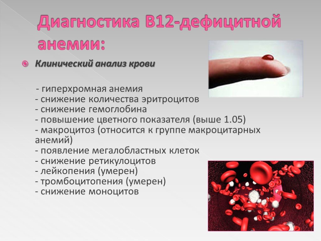 Симптомы витамина б 12. Анализ крови витамин в12 дефицитная анемия. Витамины витамины б12 норма в крови. Клиника в12 дефицитной анемии. В12 анемия клинический анализ крови.