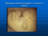 Зародыш млекопитающего в полости матки
