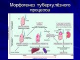 Морфогенез туберкулёзного процесса