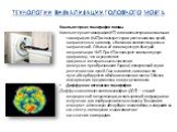 Технологии визуализации головного мозга. Компьютерная томография головы Компьютерная томография (КТ) или компьютерная аксиальная томография (КАТ) использует серии рентгеновских лучей, направленных на голову, с большого количества разных направлений. Обычно её используют для быстрой визуализации ЧМТ.