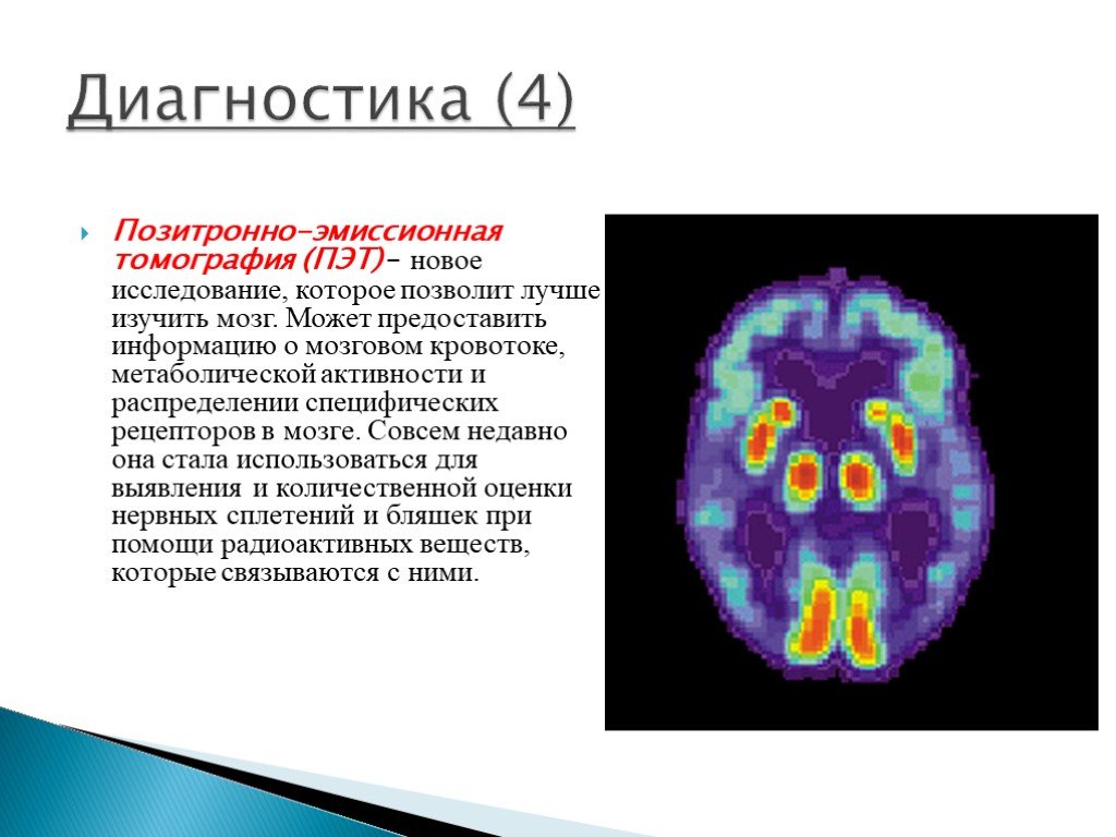 Метаболическая активность на пэт. Позитронно-эмиссионная томография мозга (ПЭТ). Позитронно-эмиссионная томография презентация. Позитронно-эмиссионный томограф. Метод позитронно-эмиссионной томографии.