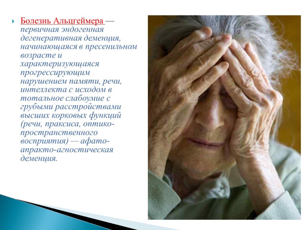 Болезнь памяти у пожилых. Болезни старческого возраста. Нарушение памяти у пожилых. Слабоумие у пожилых. Болезнь Альцгеймера больные.