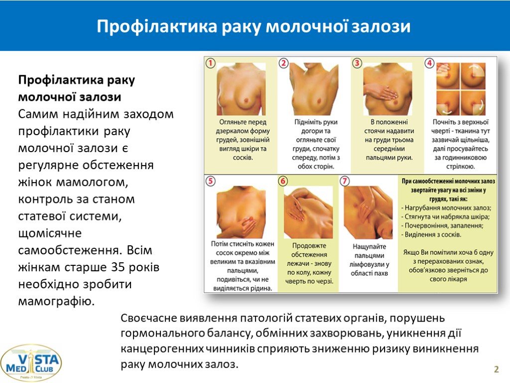 Самообследование молочных желез картинки