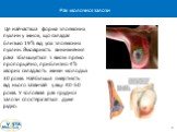 Це найчастіша форма злоякісних пухлин у жінок, що складає близько 19% від усіх злоякісних пухлин. Ймовірність виникнення рака збільшується з віком прямо пропорційно, приблизно 4% хворих складають жінки молодші 30 років. Найбільша смертність від нього зазвичай у віці 40-50 років. У чоловіків рак груд