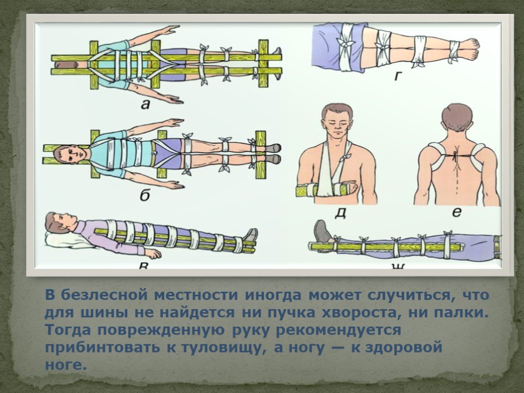 Виды ранений их причины и первая помощь обж 5 класс презентация