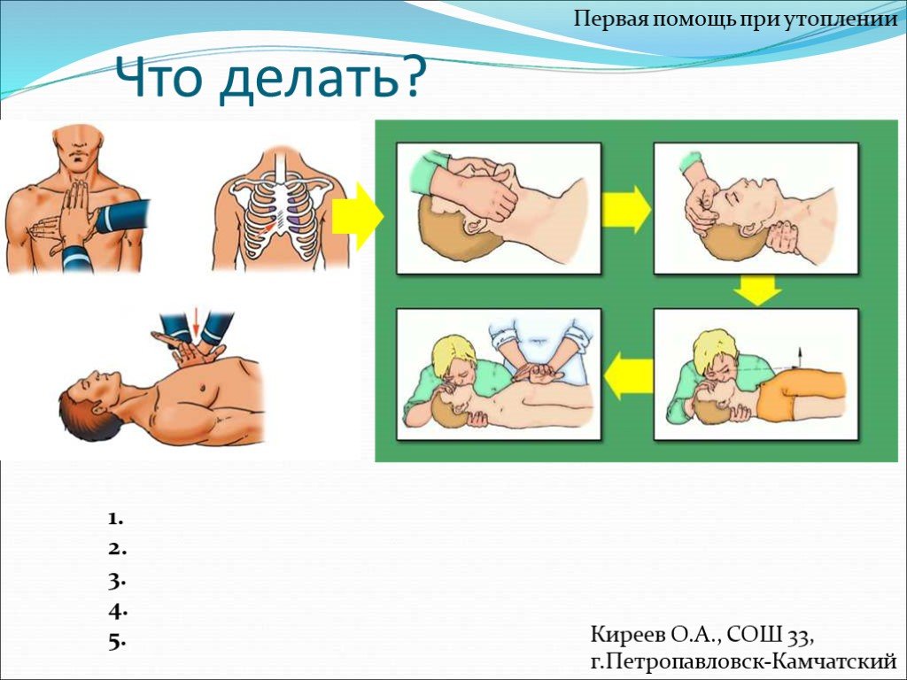 Утопление картинки первая помощь