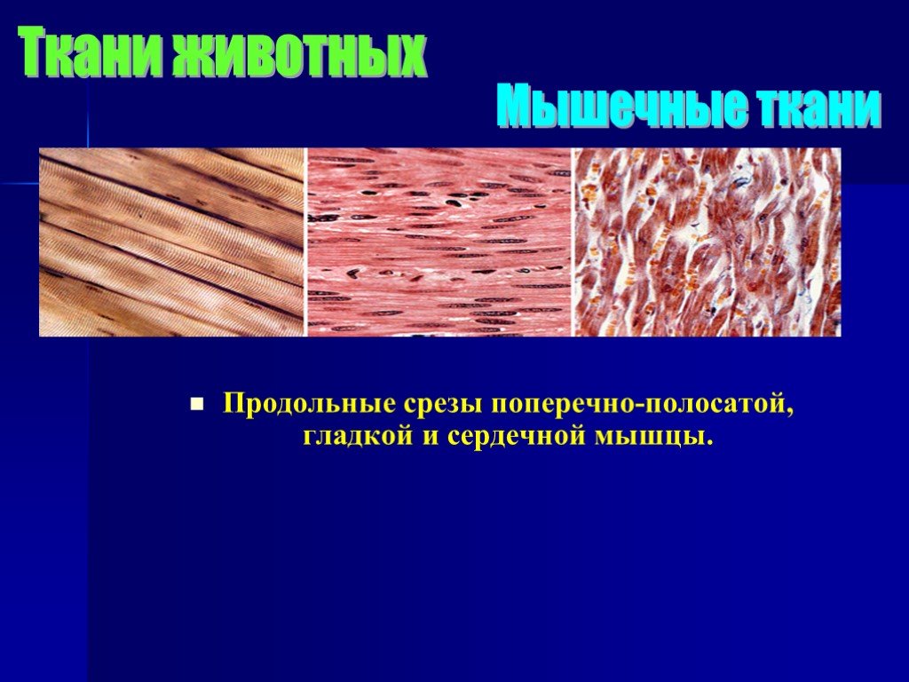 Клетка сердечной поперечно полосатой мышечной ткани. Продольный срез поперечно полосатой мышечной ткани. Поперечно полосатая сердечная мышечная ткань поперечный срез. Продольно и поперечно полосатые мышцы. Срез сердечной поперечно полосатой мышечной ткани.