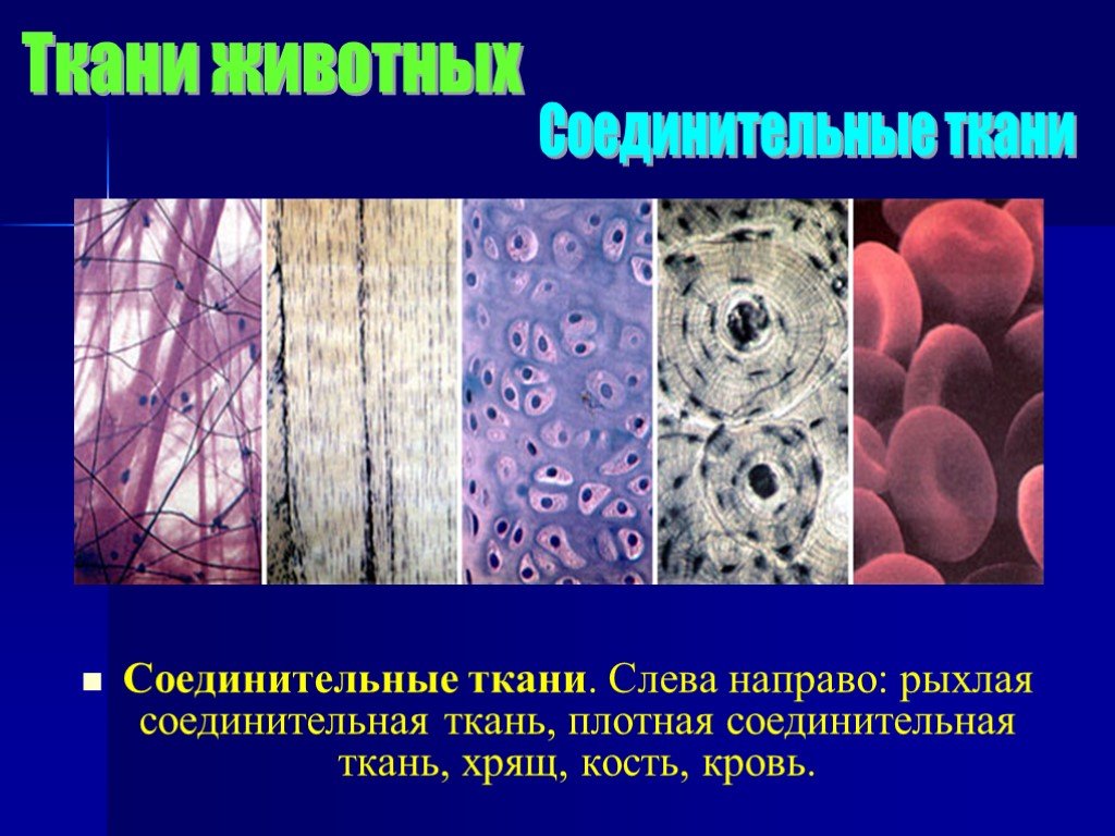 К соединительной ткани относится выберите 3. Плотная соединительная ткань. Рыхлая и плотная соединительная ткань. Хрящевая соединительная ткань. Соединительная ткань хрящ.