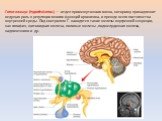 Гипоталамус (hypothalamus) — отдел промежуточного мозга, которому принадлежит ведущая роль в регуляции многих функций организма, и прежде всего постоянства внутренней среды. Под контролем Г. находятся такие железы внутренней секреции, как гипофиз, щитовидная железа, половые железы ,поджелудочная жел