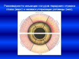 Разновидности инъекции сосудов переднего отрезка глаза (верх) и неоваскуляризации роговицы (низ).