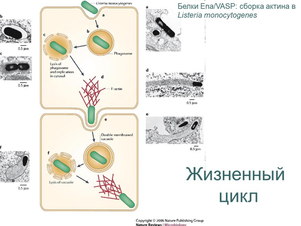 Listeria monocytogenes что это