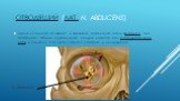 отводящий (лат. n. abducens). Выйдя из синуса, он входит в верхнюю глазничную щель вглазницу, где прободает общее сухожильное кольцо, ложится под глазодвигательный нерв и подходит к m.rectus lateralis, которую и иннервирует. n. abducens