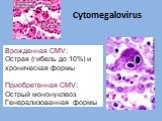 Сytomegalovirus. Врожденная CMV: Острая (гибель до 10%) и хроническая формы Приобретенная CMV: Острый мононуклеоз Генерализованная формы