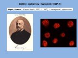 Вирус саркомы Капоши (HHV8). Мориц Капоши (Kaposi Moritz 1837 — 1902) — венгерский дерматолог