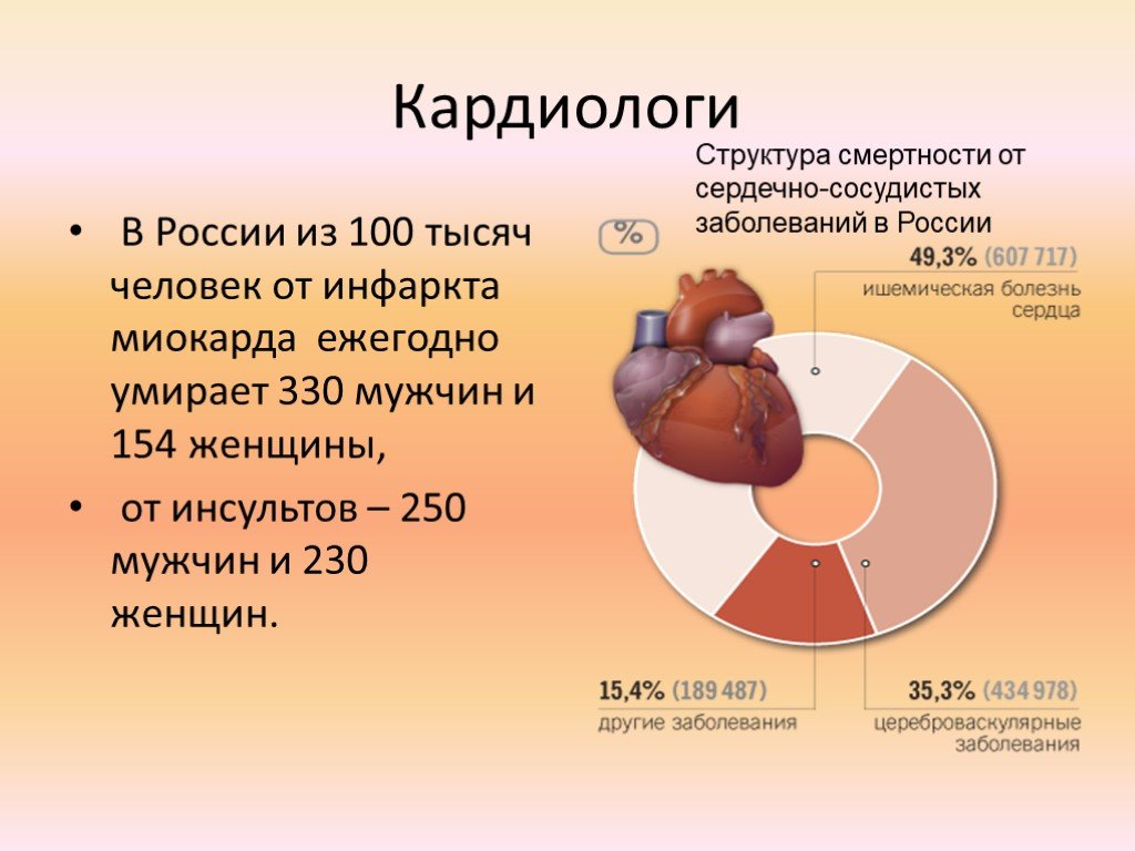 Инфаркт возраст у мужчин. Статистика заболеваний инфаркта миокарда. Статистика заболеваемости инфарктом миокарда. Статистика больных инфарктом миокарда. Статистика заболеваемости инфарктом миокарда в России.