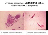 Стадии развития Leishmania sp. в клиническом материале. В организме москита-промастигота. В организме позвоночных-амастигота
