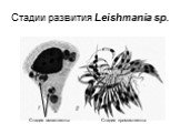 Стадии развития Leishmania sp. Стадия амастиготы. Стадия промастиготы