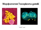 Морфология Toxoplasma gondii. 2-4х4-7 мкм