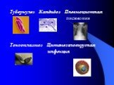 Туберкулез Кандидоз Пневмоцистная пневмония Токсоплазмоз Цитомегаловирусная инфекция