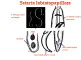 Setaria labiatopapilloza. головной конец паразита. хвостовой конец самца. хвостовой конец самки. яйца