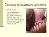 Клиника катарального стоматита. Отмечается гиперсаливация (повышенное выделение слюны). Может отмечаться кровоточивость десен, появляться дурной запах из рта.