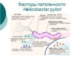 Факторы патогенности Helicobacter pylori. (аммиак, СО2)