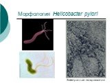 Морфология Helicobacter pylori. Электронная микроскопия