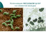 Колонизация Helicobacter pylori на слизистой желудка