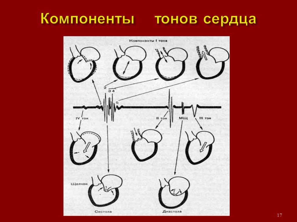 1 тон сердца. Компоненты сердечных тонов. Компоненты 2 тона сердца. Первый тон сердца компоненты. Компоненты 1 и 2 тонов сердца.