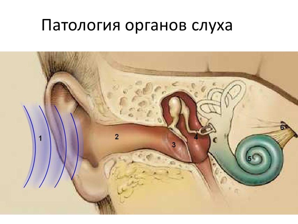 Анатомия физиология и патология органов слуха презентация