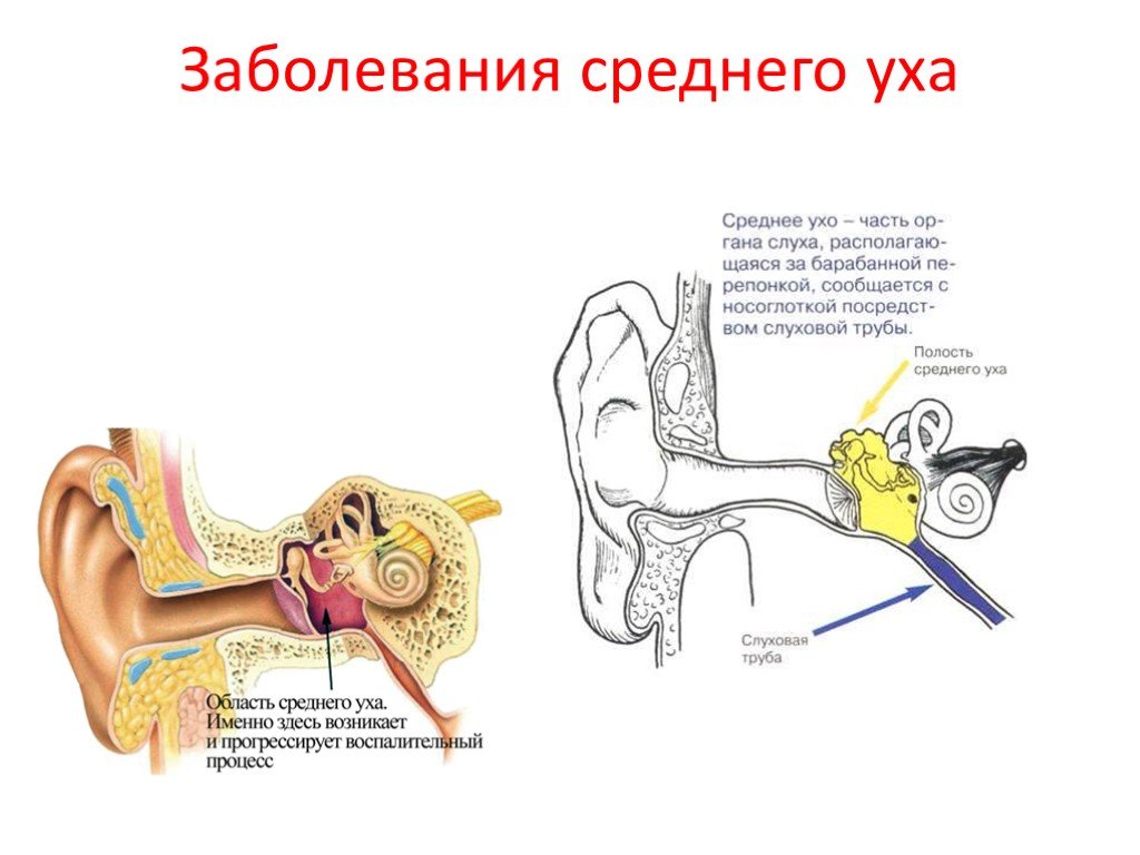 Презентация заболевания органов слуха