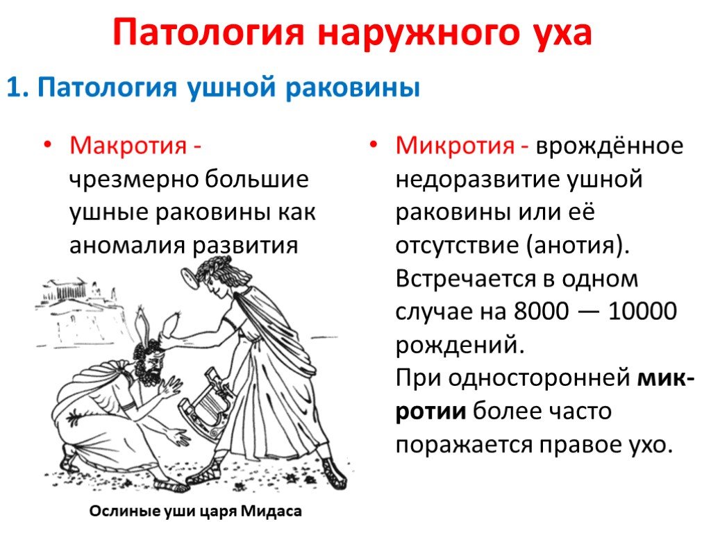 Аномалии развития уха презентация