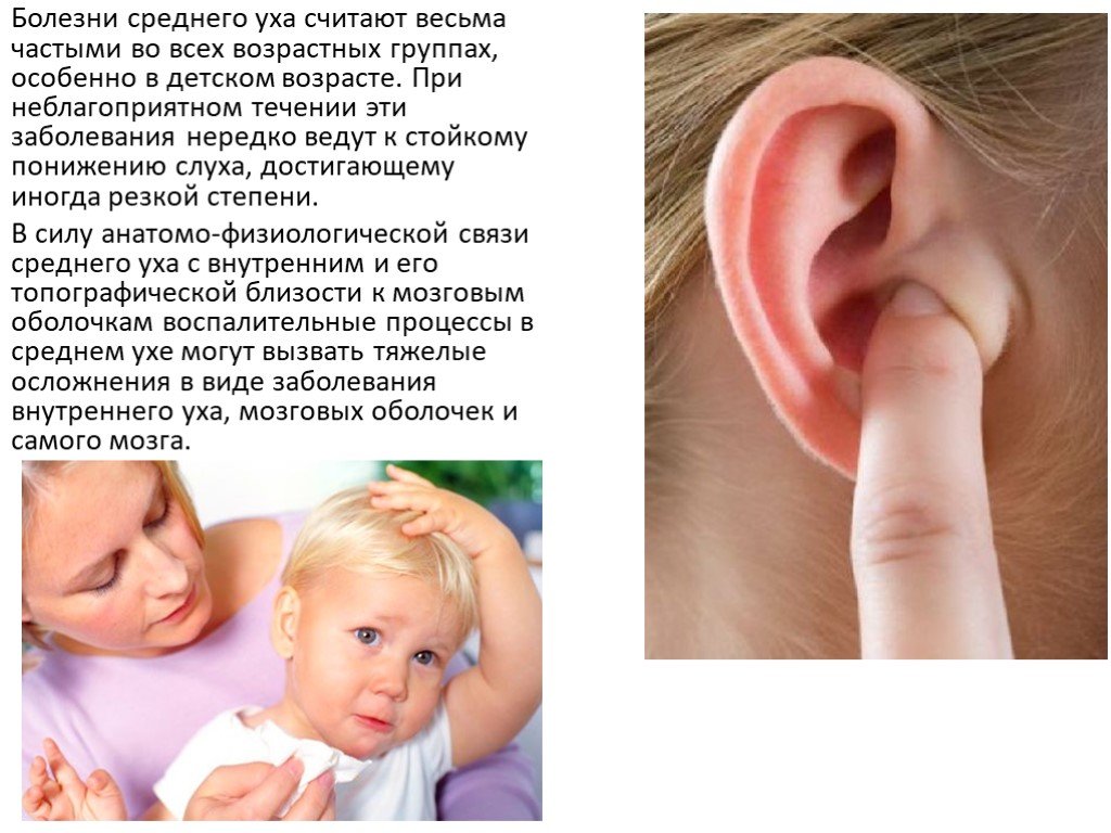 Нарушение среднего уха. Заболевания органов слуха.