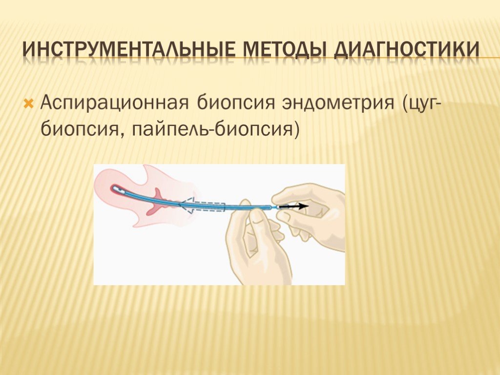 Биопсия полости матки. Техника выполнения пайпель биопсии эндометрия. Пайпель биопсия гистология. Аспирационная пайпель биопсия эндометрия. Пайпель биопсия протокол операции.