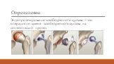 Определение. Эндопротезирование тазобедренного сустава – это операция по замене тазобедренного сустава на синтетический протез.