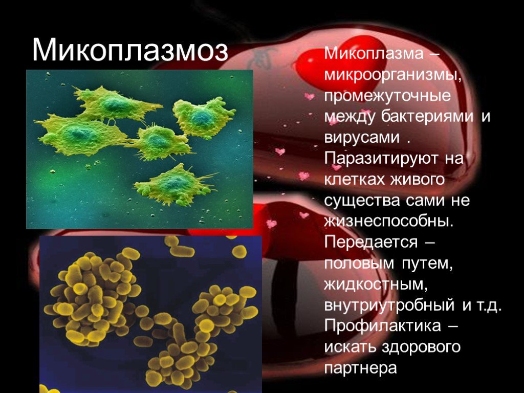 Chlamydia trachomatis mycoplasma genitalium. Микоплазмы - возбудители заболеваний дыхательных путей. Микоплазмоз ИППП микробиология. Микоплазма заболевания у человека.